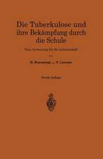 Die Tuberkulose und ihre Bekämpfung durch die Schule: Eine Anweisung für die Lehrerschaft