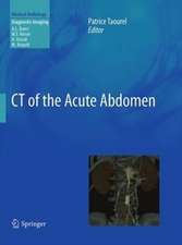 CT of the Acute Abdomen