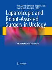 Laparoscopic and Robot-Assisted Surgery in Urology: Atlas of Standard Procedures