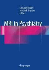 MRI in Psychiatry