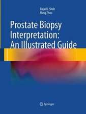 Prostate Biopsy Interpretation: An Illustrated Guide