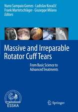 Massive and Irreparable Rotator Cuff Tears