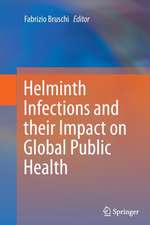 Helminth Infections and their Impact on Global Public Health