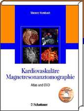 Kardiovaskuläre Magnetresonanztomographie