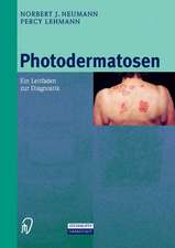 Photodermatosen: Ein Leitfaden zur Diagnostik