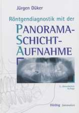 Röntgendiagnostik mit der Panoramaschichtaufnahme