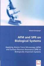 AFM and SPR on Biological Systems