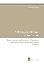 Split Hand/Split Foot Malformation: Ein Zytokin Der Il-10-Interferon-Familie