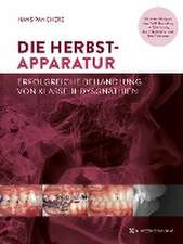 Die Herbst-Apparatur