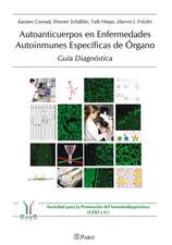 Autoanticuerpos en Enfermedades Autoinmunes Especificas de Organo