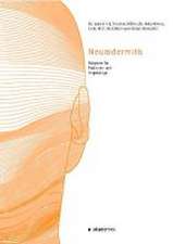 Neurodermitis