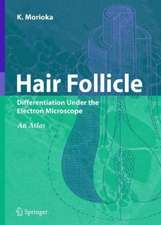 Hair Follicle: Differentiation under the Electron Microscope - An Atlas