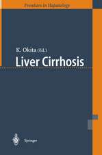 Liver Cirrhosis