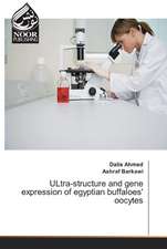 ULtra-structure and gene expression of egyptian buffaloes' oocytes