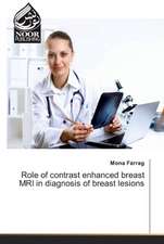 Role of contrast enhanced breast MRI in diagnosis of breast lesions