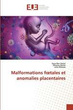 Malformations f¿tales et anomalies placentaires