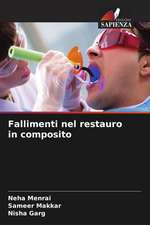 Fallimenti nel restauro in composito