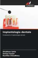 Implantologia dentale