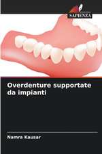 Overdenture supportate da impianti