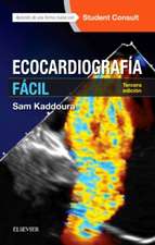 Ecocardiografía fácil ; StudentConsult