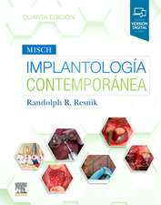 Implantolog?a contemporanea 4? Edici?n