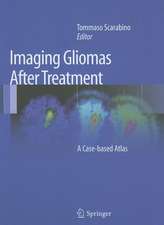 Imaging Gliomas After Treatment: A Case-based Atlas