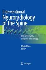 Interventional Neuroradiology of the Spine: Clinical Features, Diagnosis and Therapy