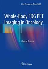 Whole-Body FDG PET Imaging in Oncology: Clinical Reports