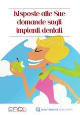 Risposte alle Sue domande sugli impianti dentali