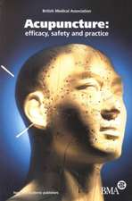 Acupuncture: Efficacy, Safety and Practice