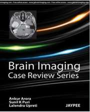 Arora, A: Brain Imaging