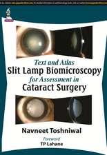 Text and Atlas: Slit Lamp Biomicroscopy for Assessment in Cataract Surgery