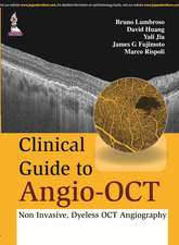 Clinical Guide to Angio-OCT: Non Invasive, Dyeless OCT Angiography