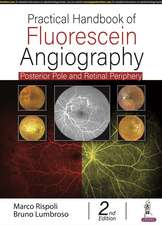 Practical Handbook of Fluorescein Angiography: Posterior Pole and Retinal Periphery