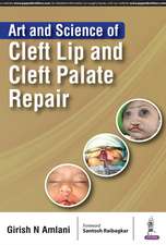 Art and Science of Cleft Lip and Cleft Palate Repair