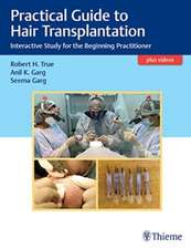 Practical Guide to Hair Transplantation – Interactive Study for the Beginning Practitioner