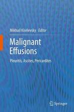 Malignant Effusions: Pleuritis, Ascites, Pericardites