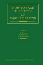 How to face ‘the faces’ of CARDIAC PACING