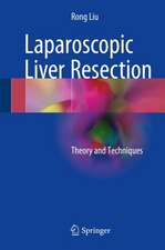 Laparoscopic Liver Resection: Theory and Techniques