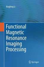 Functional Magnetic Resonance Imaging Processing