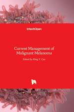 Current Management of Malignant Melanoma