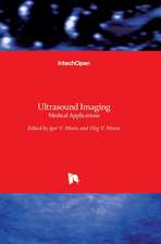 Ultrasound Imaging