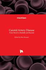 Carotid Artery Disease