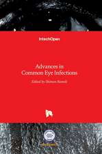 Advances in Common Eye Infections