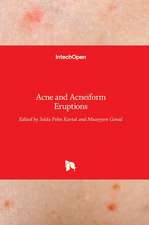 Acne and Acneiform Eruptions