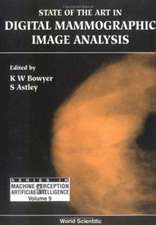 State of the Art in Digital Mammographic Image Analysis