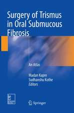 Surgery of Trismus in Oral Submucous Fibrosis: An Atlas