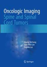 Oncologic Imaging: Spine and Spinal Cord Tumors