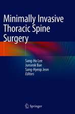 Minimally Invasive Thoracic Spine Surgery