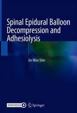 Spinal Epidural Balloon Decompression and Adhesiolysis